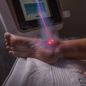 Smertepakke med Cryokammer & Lokalcryo